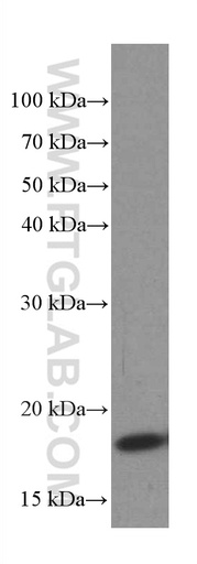 [66402-1-IG-150UL] TPRKB Monoclonal antibody