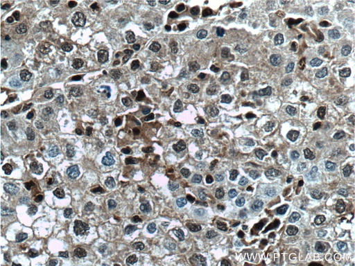 [66403-1-IG-150UL] PSMB10 Monoclonal antibody
