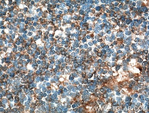 [66406-1-IG-150UL] CD80/B7-1 Monoclonal antibody