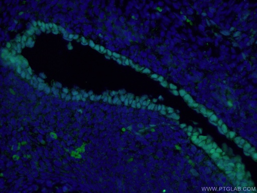 [66411-1-IG-150UL] SOX2 Monoclonal antibody