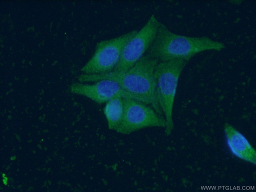 [66413-1-IG-20UL] ZC3HAV1 Monoclonal antibody
