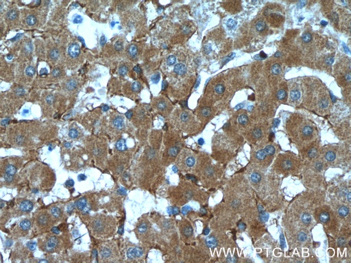 [66414-1-IG-150UL] LDLR Monoclonal antibody