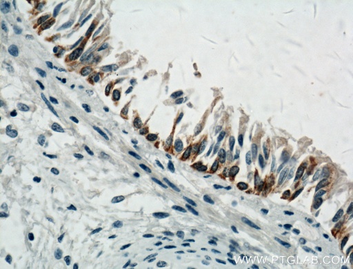 [66417-1-IG-20UL] LAP3 Monoclonal antibody
