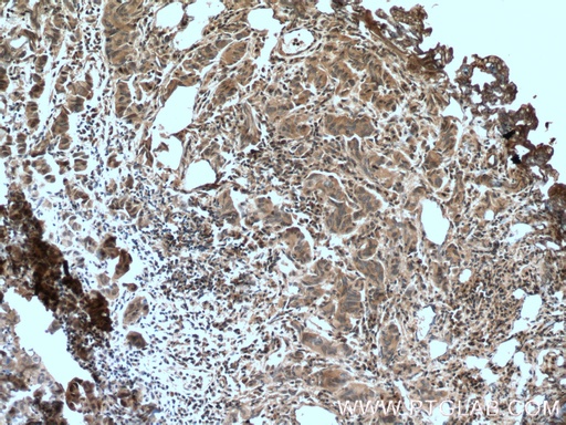 [66418-1-IG-20UL] IkB Alpha Monoclonal antibody