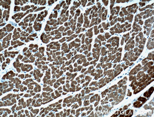 [66419-1-IG-150UL] Calsequestrin 2 Monoclonal antibody
