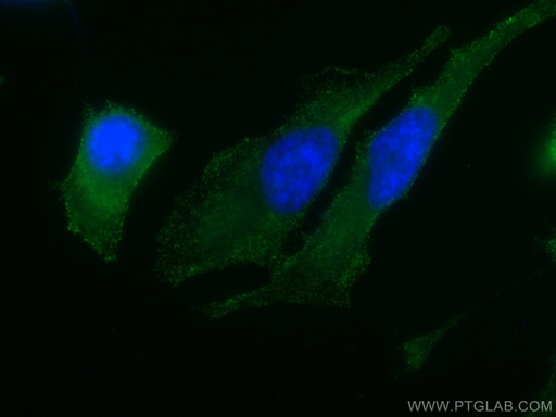 [66421-1-IG-150UL] PKC Alpha Monoclonal antibody