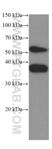[66426-1-IG-150UL] SPARC Monoclonal antibody