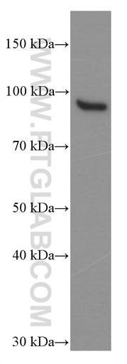 [66427-1-IG-150UL] STAT5B Monoclonal antibody