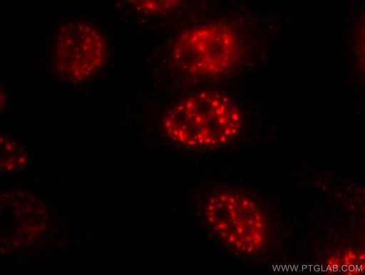 [66428-1-IG-20UL] FOXO3A Monoclonal antibody