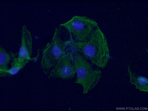 [66429-1-IG-20UL] PKC Gamma Monoclonal antibody
