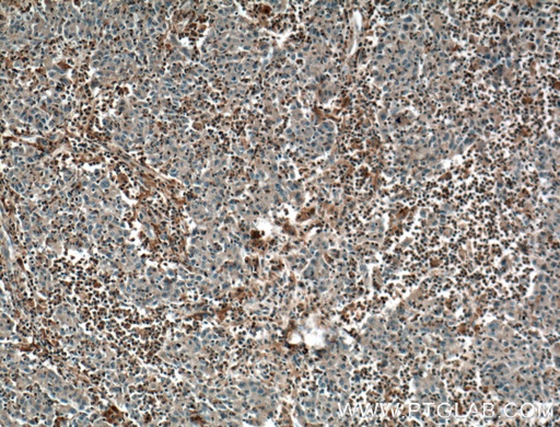 [66431-1-IG-20UL] PLEK Monoclonal antibody