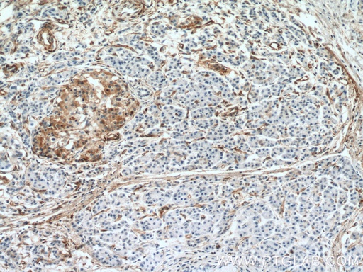 [66433-1-IG-20UL] Amphiregulin Monoclonal antibody