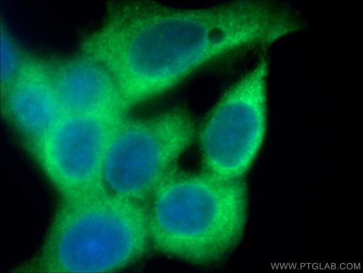 [66434-1-IG-20UL] GDI1 Monoclonal antibody