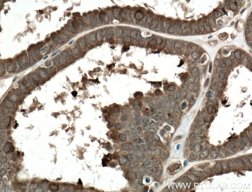 [66435-1-IG-20UL] COPS2 Monoclonal antibody