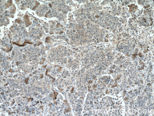 [66438-1-IG-150UL] PEBP1 Monoclonal antibody