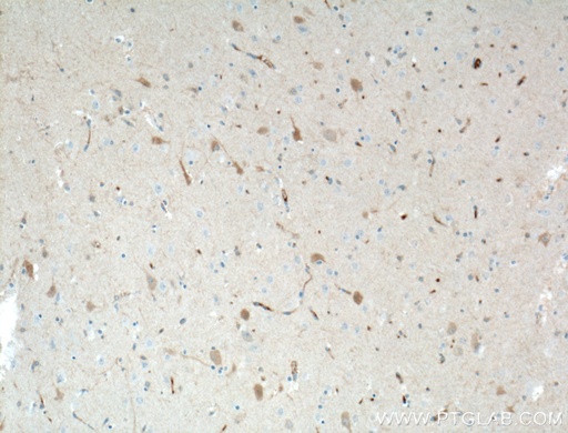 [66439-1-IG-20UL] KChIP1 Monoclonal antibody