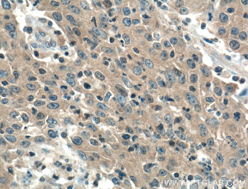 [66440-1-IG-20UL] PDCD10 Monoclonal antibody