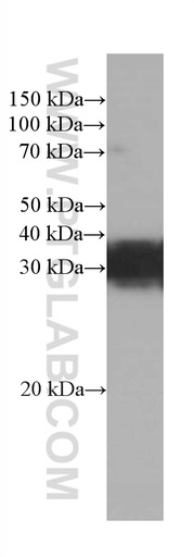 [66441-1-IG-20UL] RGS4 Monoclonal antibody