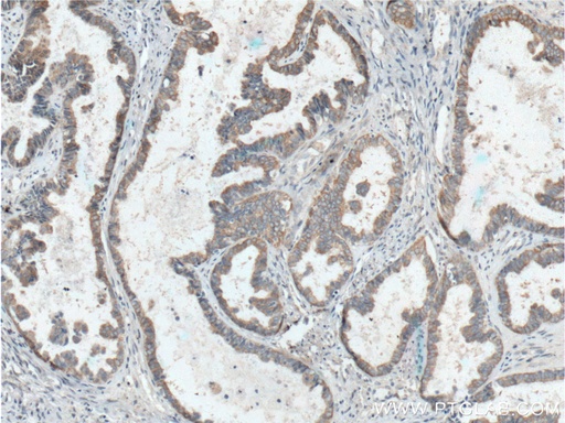 [66442-1-IG-20UL] Hsc70 Monoclonal antibody
