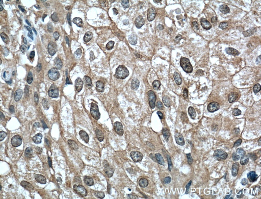 [66444-1-IG-20UL] Phospho-AKT (Ser473) Monoclonal antibody