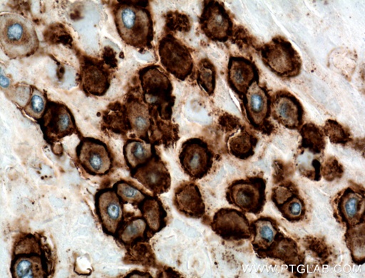 [66447-1-IG-150UL] HLA-G Monoclonal antibody