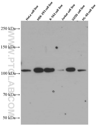 [66448-1-IG-20UL] CP110 Monoclonal antibody