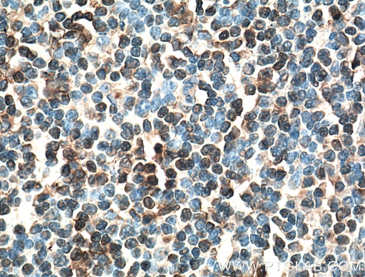 [66451-1-IG-20UL] IRF4 Monoclonal antibody