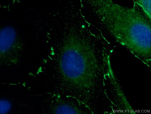 [66452-1-IG-20UL] ZO-1 Monoclonal antibody
