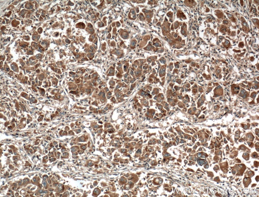 [66453-1-IG-20UL] GNPAT Monoclonal antibody