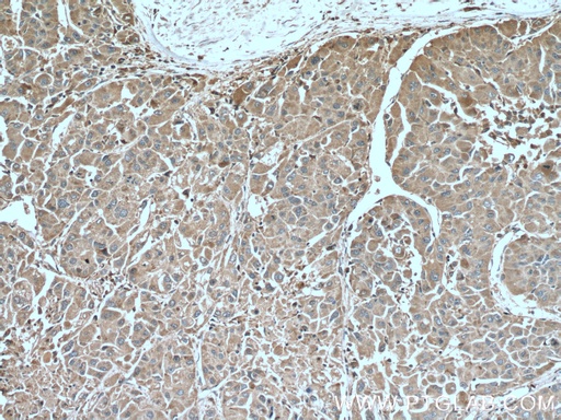 [66454-1-IG-150UL] SERPINA7 Monoclonal antibody