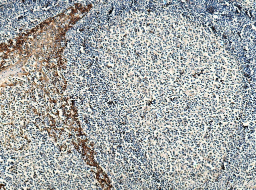[66455-1-IG-20UL] EGFR Monoclonal antibody