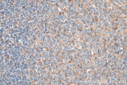 [66456-1-IG-20UL] Lysozyme Monoclonal antibody