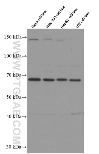 [66457-1-IG-20UL] FOXO1 Monoclonal antibody