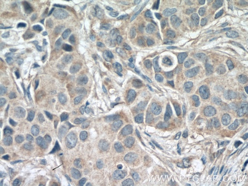[66460-1-IG-20UL] IKBKG Monoclonal antibody