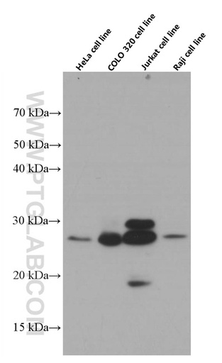 [66461-1-IG-150UL] OIP5 Monoclonal antibody