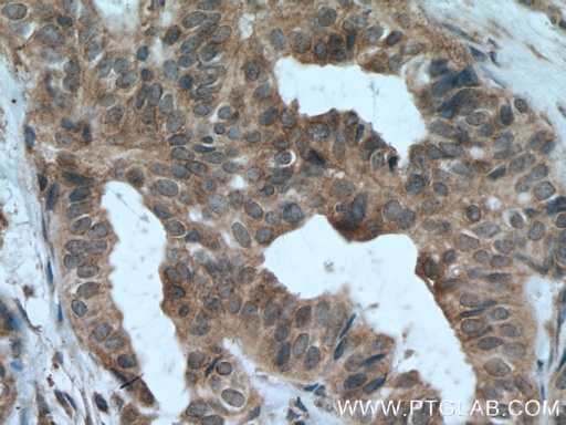 [66466-1-IG-150UL] JAK1 Monoclonal antibody