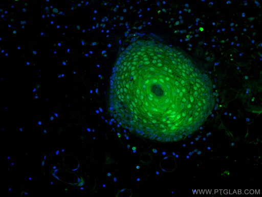 [66468-1-IG-20UL] CRABP2 Monoclonal antibody