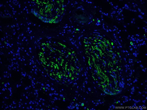 [66470-2-IG-20UL] Caspase 3/p17/p19 Monoclonal antibody