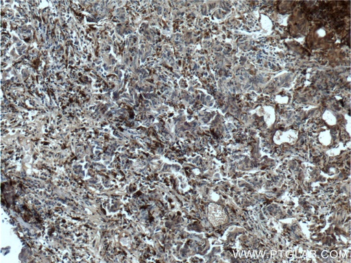 [66473-1-IG-20UL] PSAP Monoclonal antibody