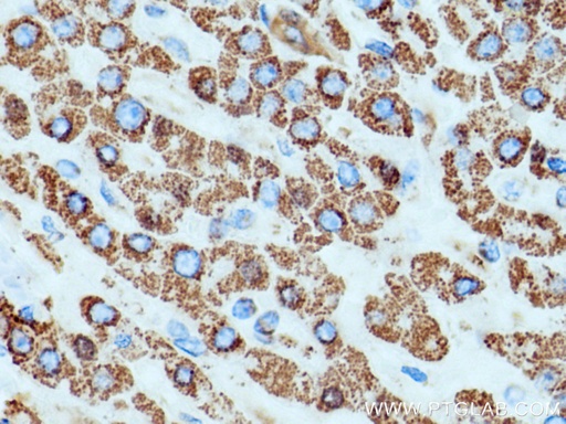 [66474-1-IG-150UL] SOD2 Monoclonal antibody