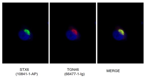[66477-1-IG-20UL] TGN46 Monoclonal antibody