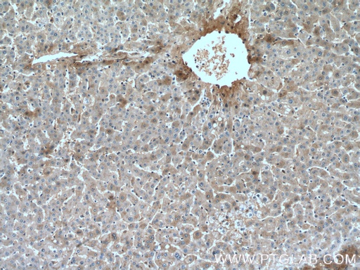 [66479-1-IG-150UL] Hemopexin Monoclonal antibody