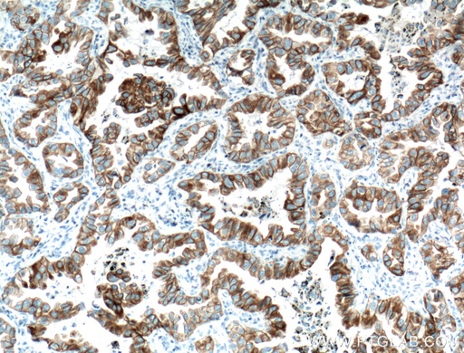 [66483-1-IG-150UL] Cytokeratin 7 Monoclonal antibody