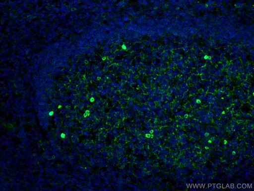 [66484-1-IG-150UL] human IgM Monoclonal antibody