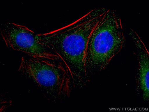 [66487-1-IG-20UL] CLTC Monoclonal antibody