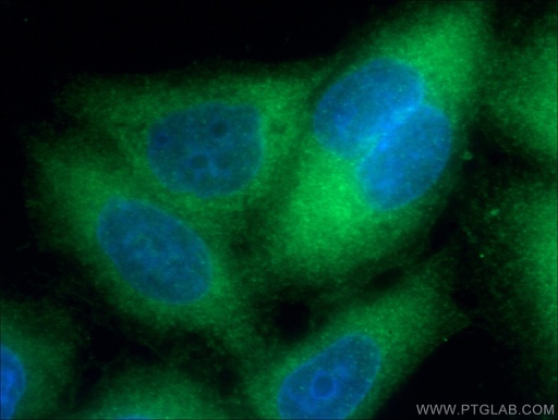 [66489-1-IG-150UL] S100A4 Monoclonal antibody