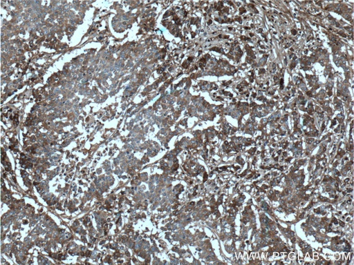 [66491-1-IG-150UL] Periostin Monoclonal antibody