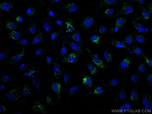 [66496-1-IG-20UL] Calretinin Monoclonal antibody