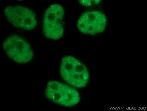 [66497-1-IG-20UL] CCAR2 Monoclonal antibody