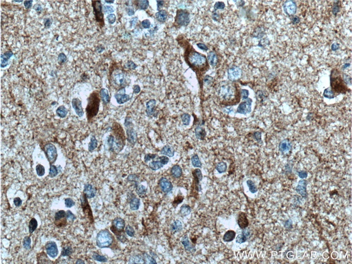 [66499-1-IG-20UL] TAU Monoclonal antibody